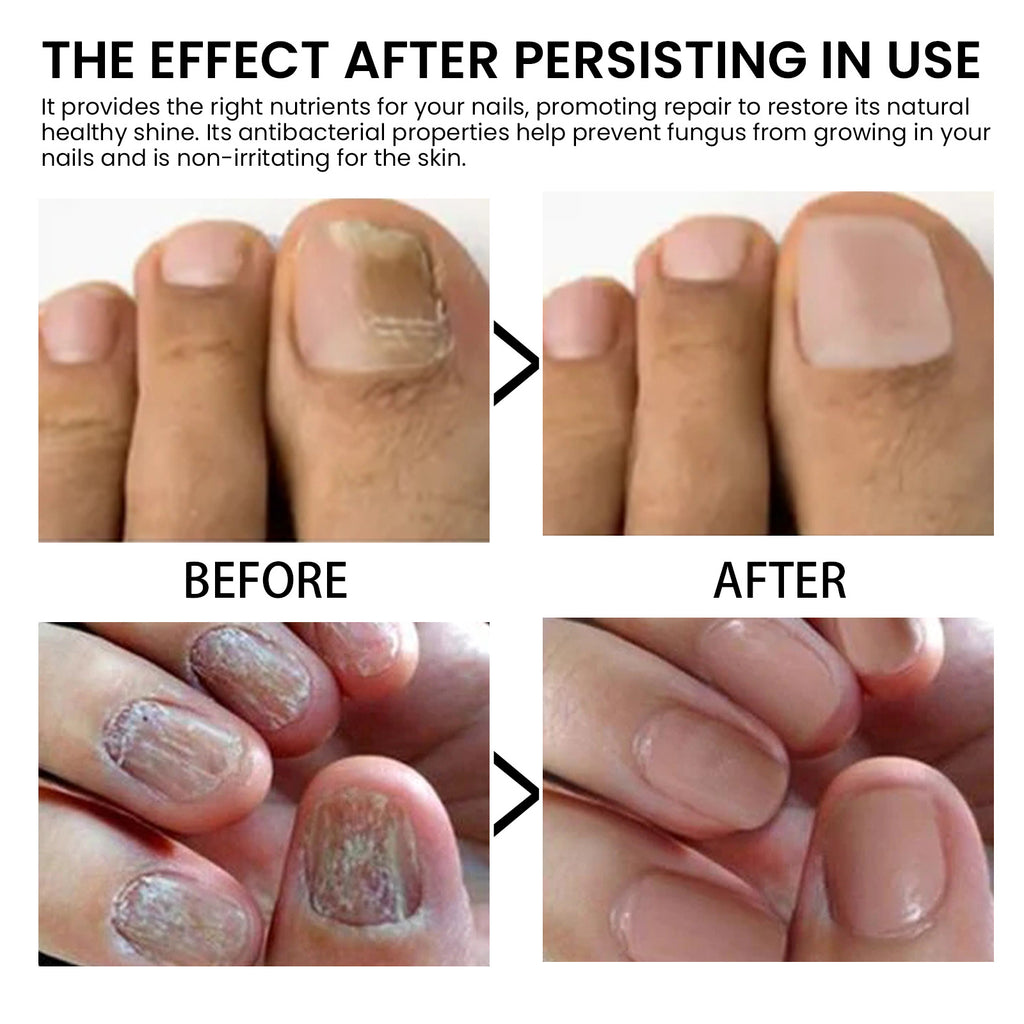 West&Month Nail Strengthening Oil for Healthy Nails