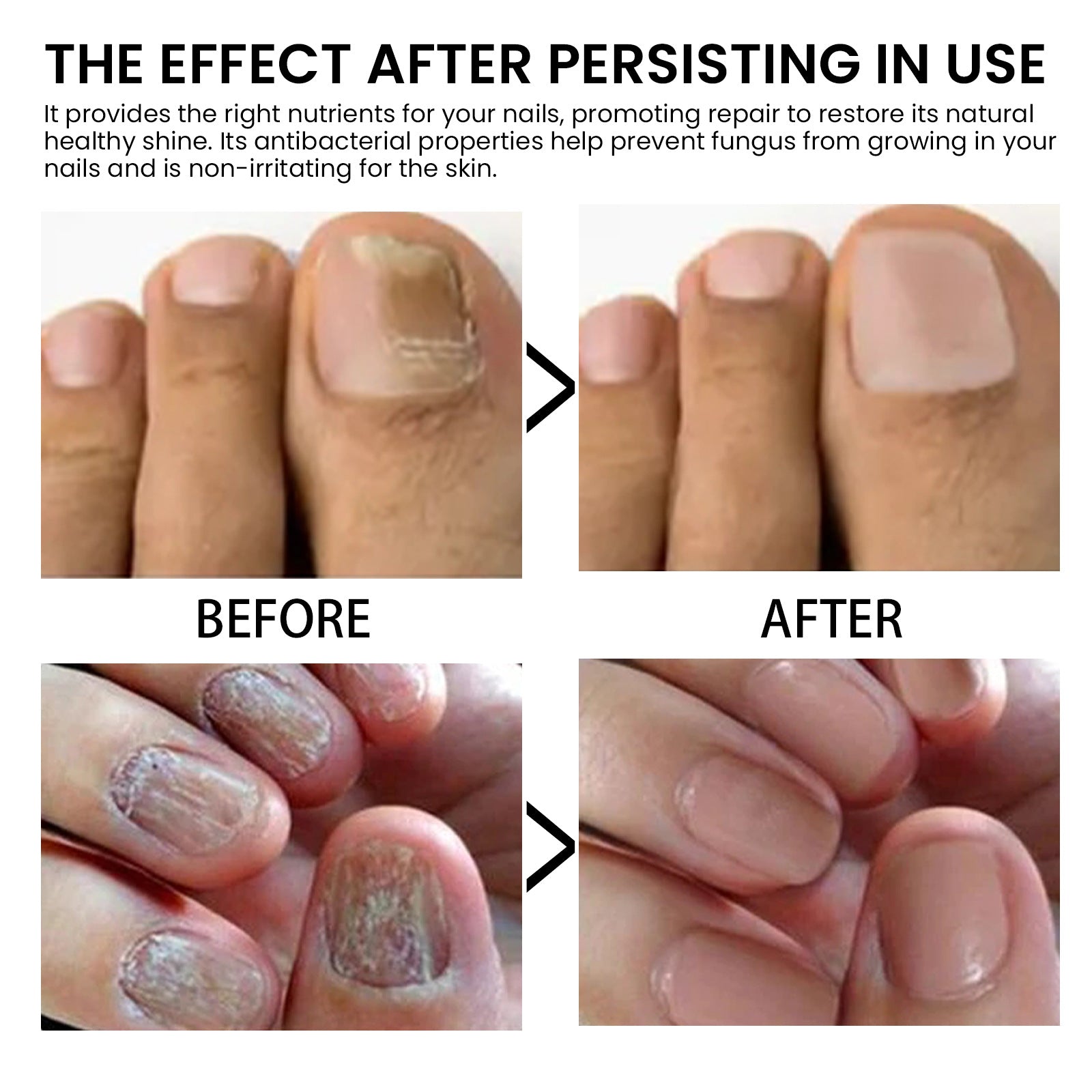 West&Month Nail Strengthening Oil for Healthy Nails